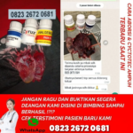 Ada 13 nama obat aborsi sebagai obat penggugur kandungan begini cara penggunaanya